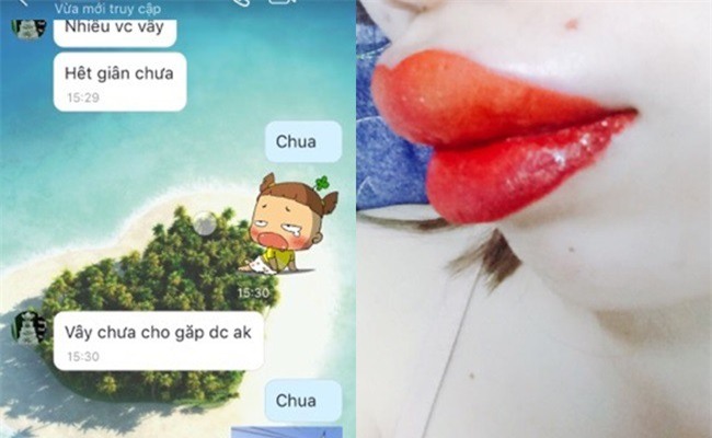 Thẩm mỹ viện quảng cáo phun môi không sưng không đau, cô gái trẻ háo hức đi làm và cái kết đắng ngắt - Ảnh 4.