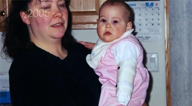 bi an can benh khien be gai khong biet cam giac dau don, tu choc tay lam mu mat - 2