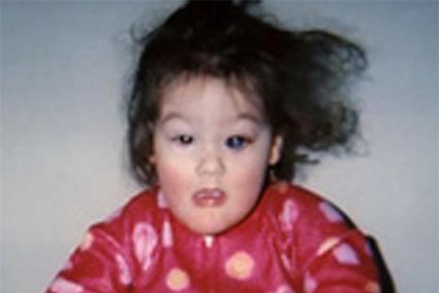 bi an can benh khien be gai khong biet cam giac dau don, tu choc tay lam mu mat - 3