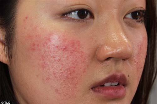 neu khong muon hoi han vi dung tinh bot nghe sai cach, hay doc ngay bai viet nay! - 6