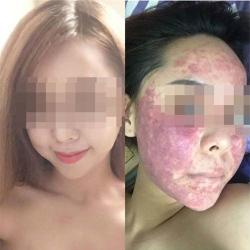 neu khong muon hoi han vi dung tinh bot nghe sai cach, hay doc ngay bai viet nay! - 7