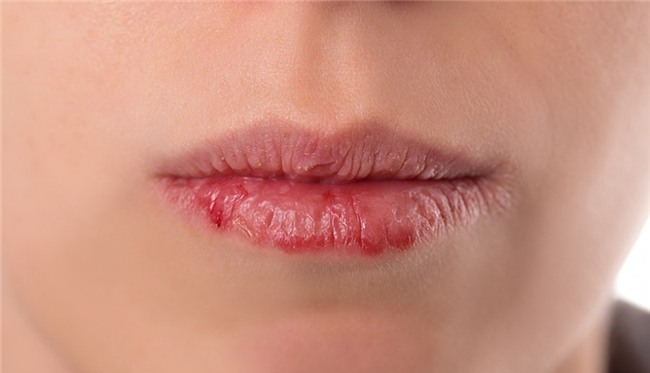 Có những dấu hiệu này chứng tỏ bạn cần giải độc cơ thể ngay lập tức - Ảnh 3.