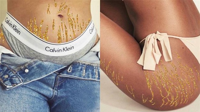 thi nhau khoe vet ran da tren instagram: trao luu sot 100 do cua hoi chi em! - 5