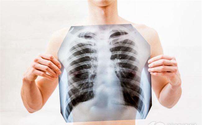 4 nhóm nghề nghiệp có nguy cơ mắc ung thư phổi cao nhất, hãy cảnh giác để phòng tránh sớm