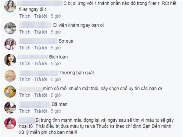 Tiêm filler nâng mũi tưởng ngon ăn mà 1 đống trường hợp biến chứng thế này, ai còn muốn làm nữa