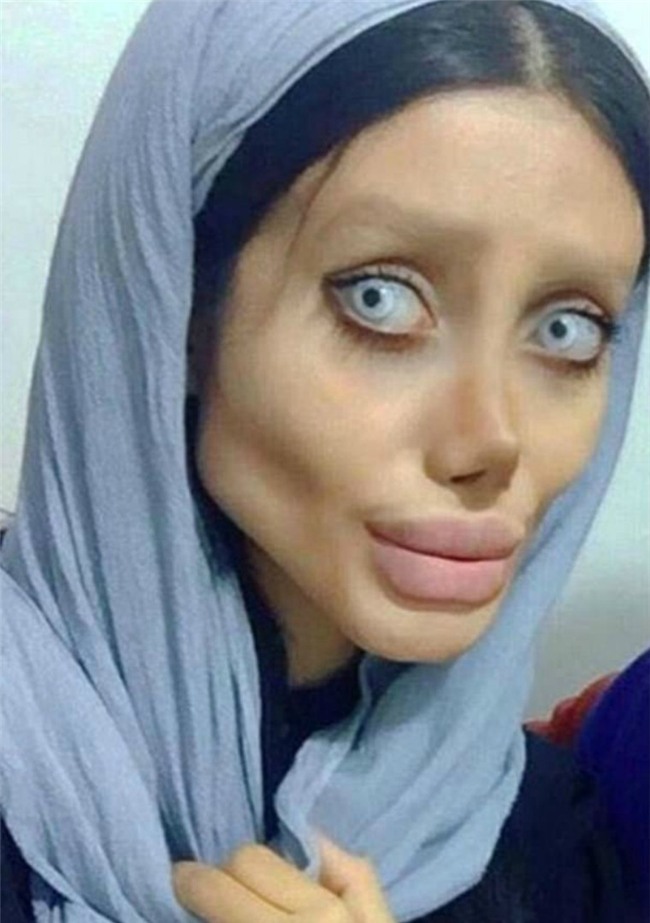 Bị dân tình ném đá dữ dội, cô gái phẫu thuật giống Angelina Jolie chính thức lên tiếng phản pháo - Ảnh 6.