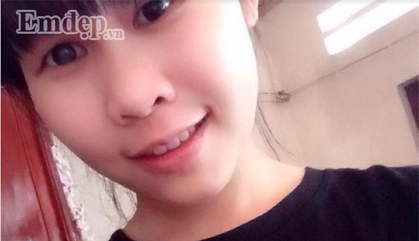 Đây chính là ‘thần dược’ giúp nàng 9x từ mặt chi chít mụn trở nên trắng bóc, mịn màng.