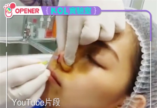 Vốn đã xinh đẹp, cô gái này vẫn phẫu thuật thẩm mỹ 30 lần chỉ để vừa mắt bạn trai - Ảnh 4.