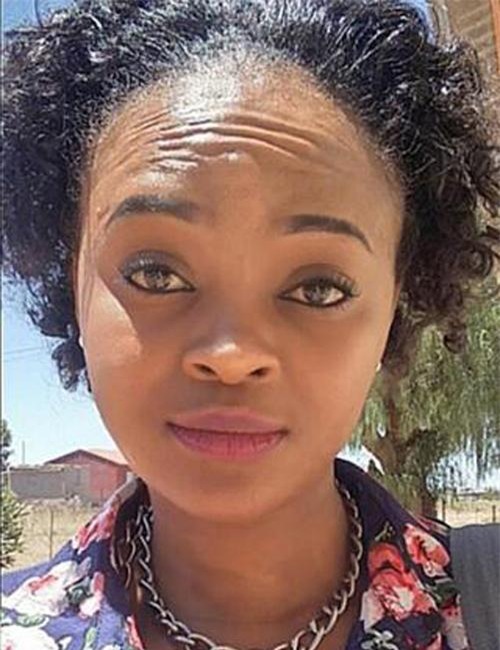 chu quan voi nhung vet mun trung ca tren mat, co gai suyt phai tra gia bang ca tinh mang - 1