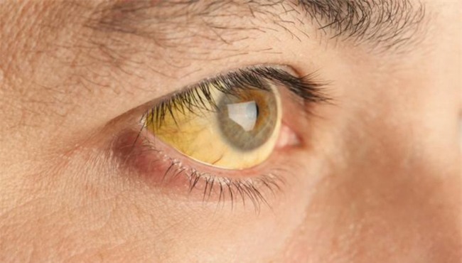 Cứ 3 người lại có 1 người không biết gì về căn bệnh ung thư rất nguy hiểm này - Ảnh 2.