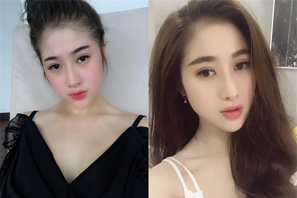 Đã sẵn xinh đẹp, cô gái này vẫn chi 400 triệu phẫu thuật thẩm mỹ để được lộng lẫy hơn-1