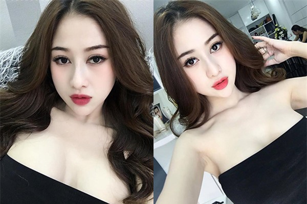 Đã sẵn xinh đẹp, cô gái này vẫn chi 400 triệu phẫu thuật thẩm mỹ để được lộng lẫy hơn-5