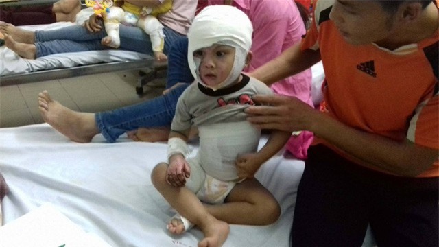 Đằng sau câu chuyện người mẹ tưới xăng vào người con trai khi vừa bỏng nặng - Ảnh 1.