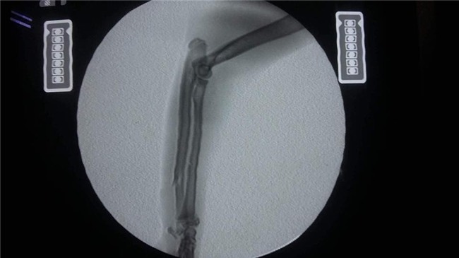 Chàng trai bán điện thoại, vay mượn khắp nơi để có đủ 40 triệu cứu mèo ngã từ tầng 5 xuống đất - Ảnh 2.