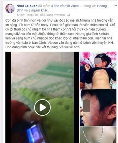 Bắc Giang: Gia đình tố con trai bị bầm tím toàn thân khi đi học ở nhà trường - Ảnh 1.