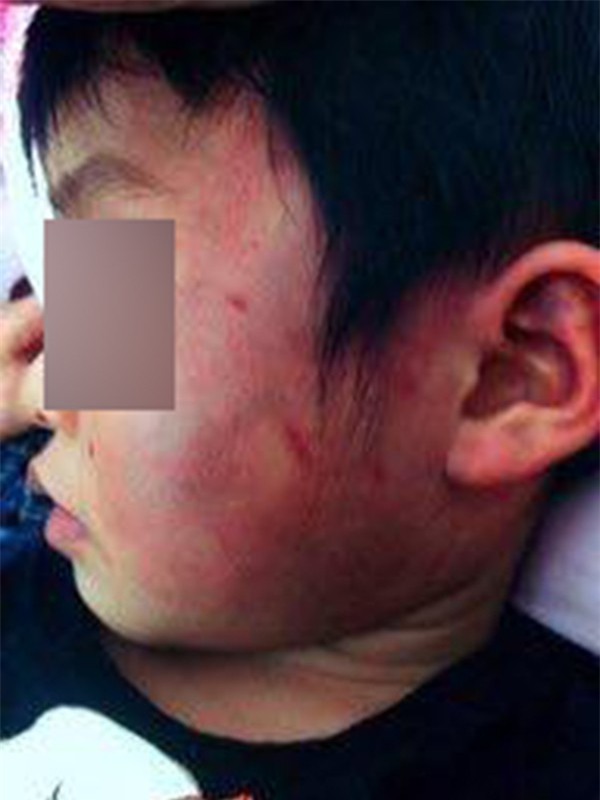 Bắc Giang: Gia đình tố con trai bị bầm tím toàn thân khi đi học ở nhà trường - Ảnh 3.