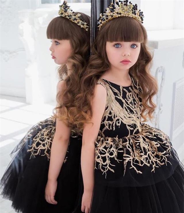 ve dep hut hon cua be gai giong het bup be, duoc ca ngoi "xinh dep nhat the gioi" - 14