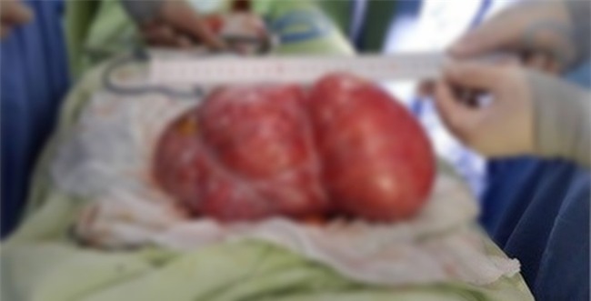 Clip tế bào ung thư gặp vàng thì tới, gặp tỏi thì chạy là hoàn toàn giả mạo - Ảnh 3.