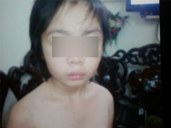 Hà Nội: Bé trai 10 tuổi tháo chạy khỏi bố và mẹ kế, tìm về ông bà nội vì bị bạo hành?