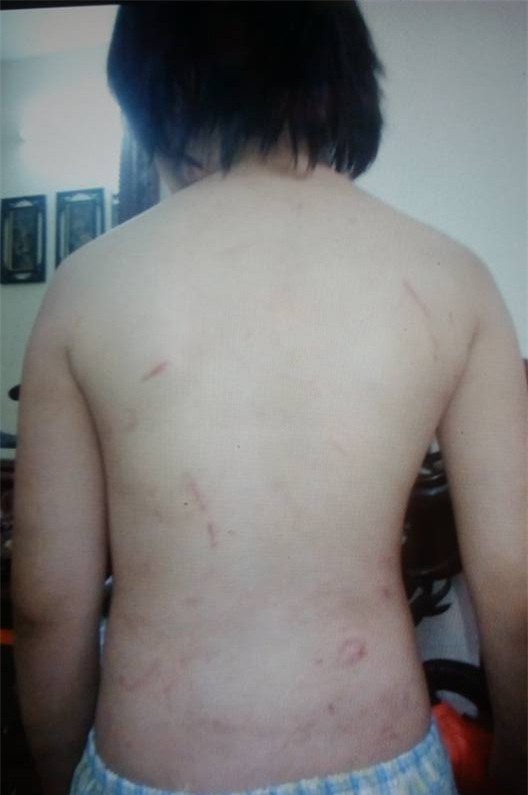 Hà Nội: Bé trai 10 tuổi tháo chạy khỏi bố và mẹ kế, tìm về ông bà nội vì bị bạo hành?