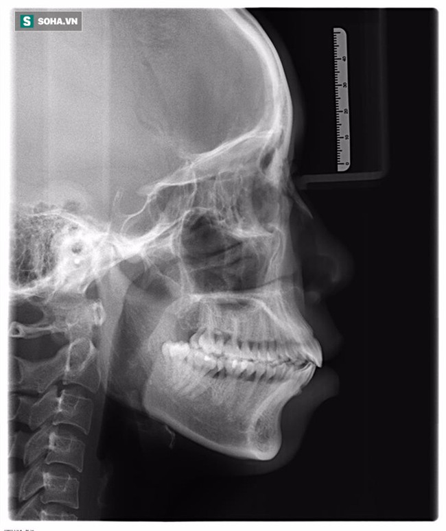 Bị tình địch chê xấu như vượn, cô gái quyết tâm đập đi xây lại cả khuôn mặt - Ảnh 3.