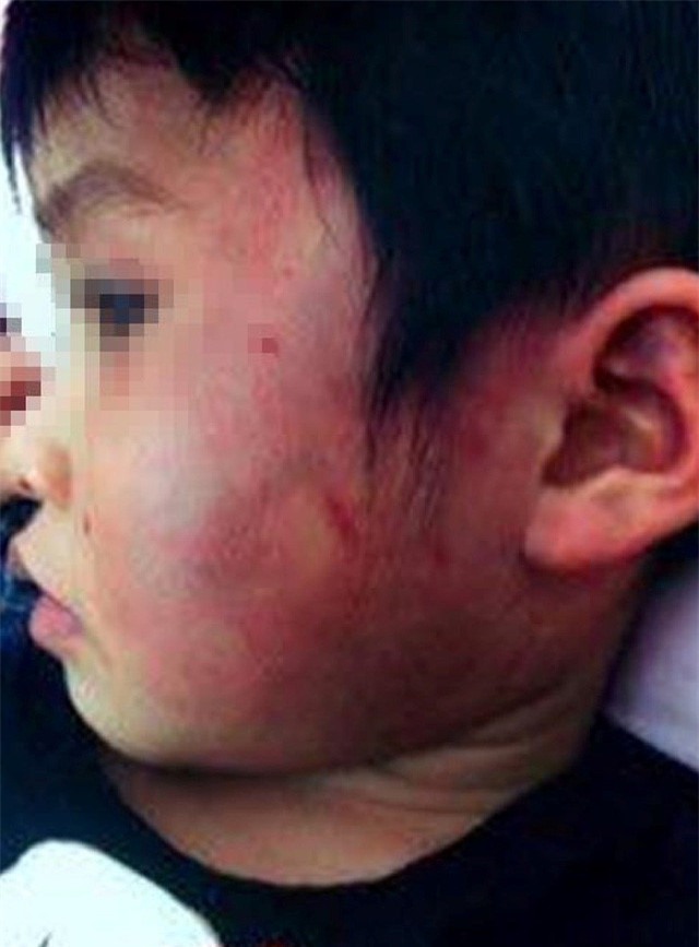 Be gai 4 tuoi bi bam tim toan than la do 'bi ban danh' hinh anh 2