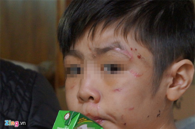 Phut tron chay khoi nha cua be 10 tuoi 'to' bi bo bao hanh hinh anh 1