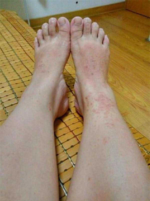 bi ngua nhung bac si cho thuoc khong uong, ba me hot hoang khi sinh ra con "da xanh" - 2