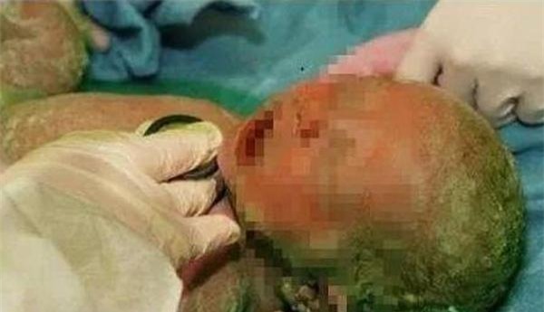 bi ngua nhung bac si cho thuoc khong uong, ba me hot hoang khi sinh ra con "da xanh" - 3