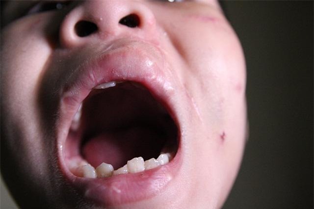 nhung vet thuong tren co the be trai 10 tuoi bi bao hanh ai nhin thay cung xot xa - 3