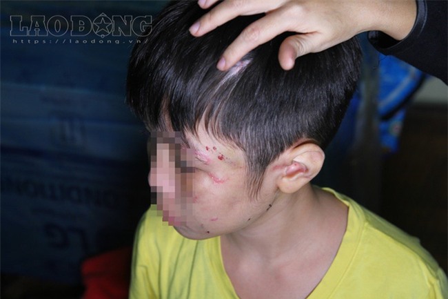Vụ bé trai bị bố, mẹ kế hành hạ: Mẹ ruột lên tiếng vì sao 2 năm không gặp con - Ảnh 2.