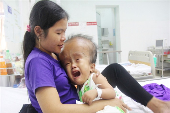 Xót cảnh bé gái 4 tuổi bị não úng thủy, đầu to gấp ba lần người thường mà bố mẹ nghèo không tiền chạy chữa - Ảnh 3.