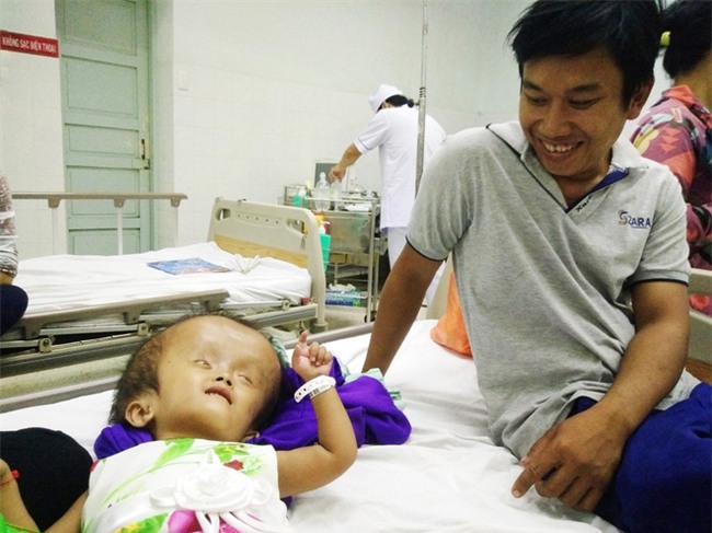 Xót cảnh bé gái 4 tuổi bị não úng thủy, đầu to gấp ba lần người thường mà bố mẹ nghèo không tiền chạy chữa - Ảnh 6.