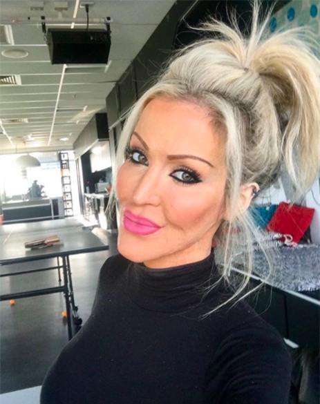 Từng bị đánh ghen, thiêu sống đến mức hủy hoại cả dung nhan, 5 năm sau người phụ nữ này đã xinh đẹp trở lại - Ảnh 5.