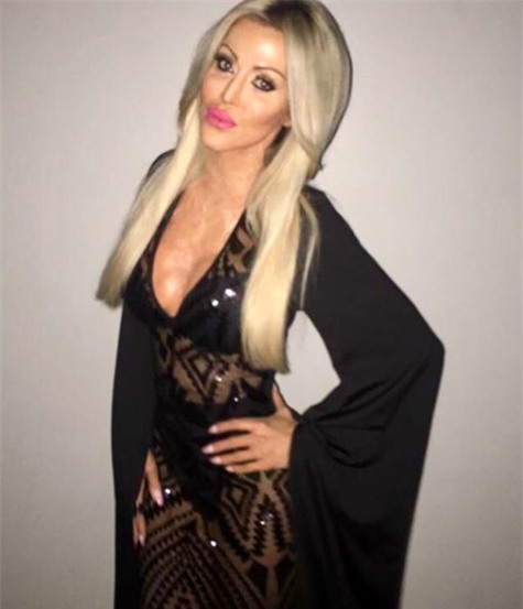 Từng bị đánh ghen, thiêu sống đến mức hủy hoại cả dung nhan, 5 năm sau người phụ nữ này đã xinh đẹp trở lại - Ảnh 6.