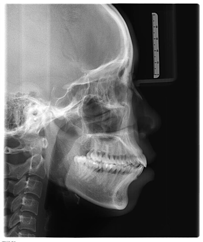 man "dap mat xay lai" vi tinh dich che xau nhu vuon gay day song cong dong mang - 1