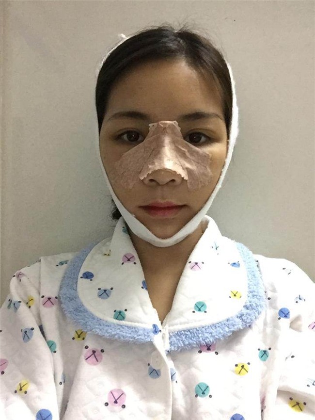 man "dap mat xay lai" vi tinh dich che xau nhu vuon gay day song cong dong mang - 4