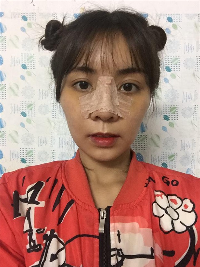 man "dap mat xay lai" vi tinh dich che xau nhu vuon gay day song cong dong mang - 8