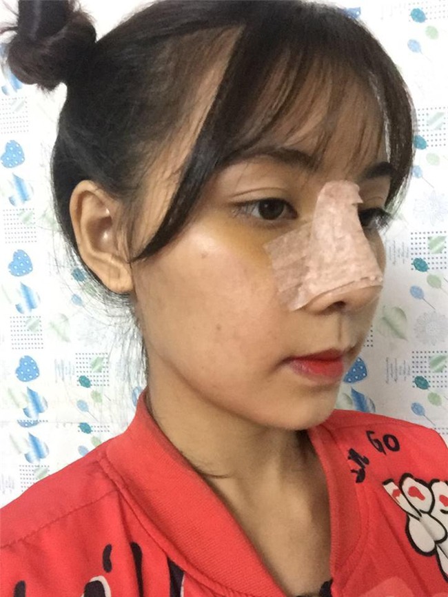 man "dap mat xay lai" vi tinh dich che xau nhu vuon gay day song cong dong mang - 9