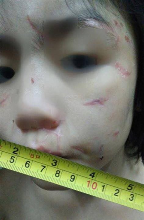 Hãy nhìn thật kỹ vào những vết sẹo của em bé bị bạo hành, bạn sẽ thấy cả sự vô cảm và bất lực của chính mình - Ảnh 3.