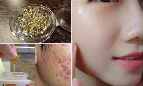 la con gai nhat dinh phai biet het nhung cong dung lam dep nay cua vitamin e - 4