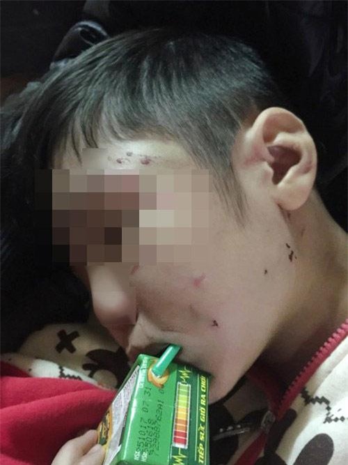 can canh nhung vat dung bo de va me ke dung de bao hanh be trai 10 tuoi - 7