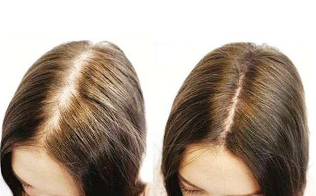 la oi – phep la de so huu mai toc va lan da dep - 7