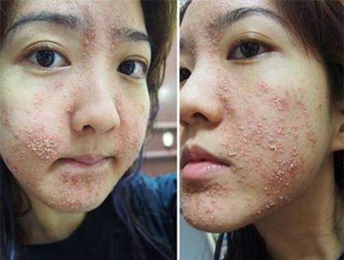 tat tan tat cong dung lam dep cua dau dua va tac hai khon luong neu dung sai cach - 12