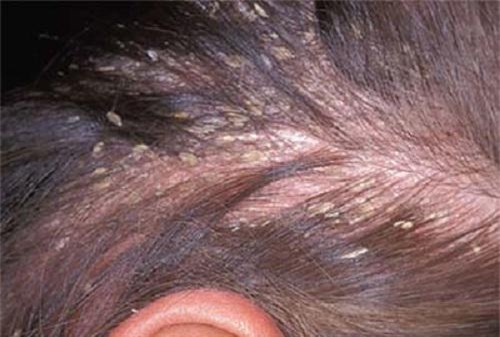 tat tan tat cong dung lam dep cua dau dua va tac hai khon luong neu dung sai cach - 13