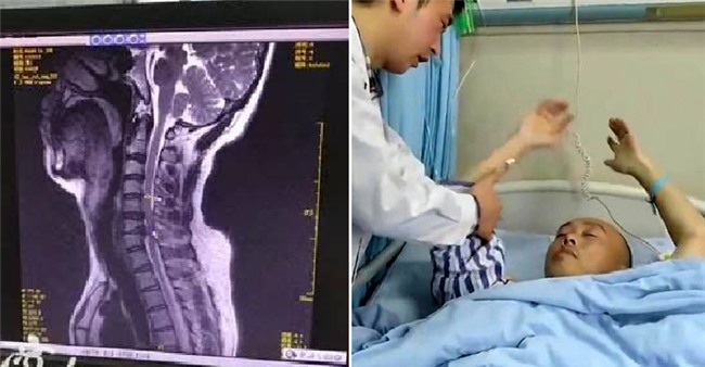 Thanh niên Trung Quốc bị liệt vì chơi game trên điện thoại 2 ngày ròng - Ảnh 2.