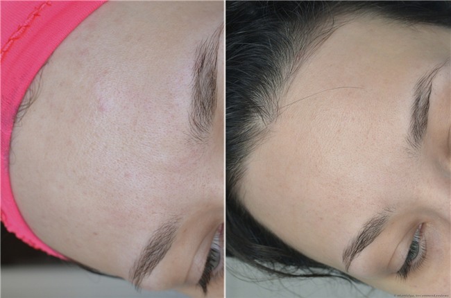 3 loại serum giá dưới 300 ngàn nhưng chất lượng lại cực xịn mà tín đồ làm đẹp nào cũng nên biết tới - Ảnh 6.