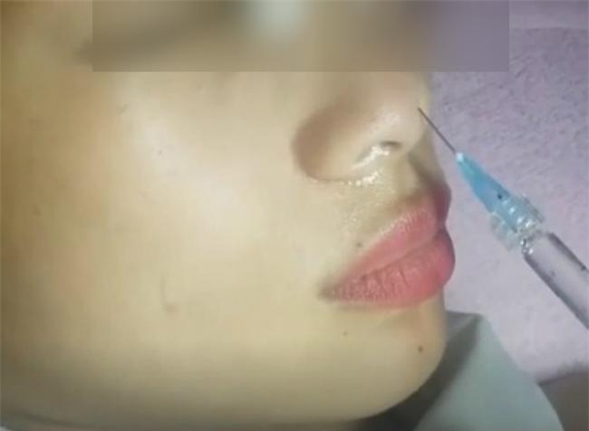 tp.hcm: co gai khoi kien co so tham my vi hong mat sau tiem chat lam day mui - 1