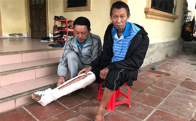 Con trai đánh bố gãy xương, bầm tím khắp người: