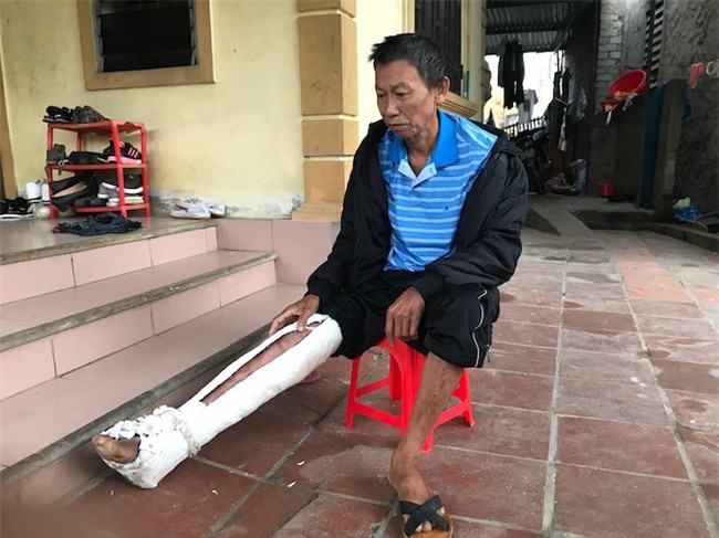 Con trai đánh bố gãy xương, bầm tím khắp người: Nó còn mang xăng định đốt cả bố - Ảnh 6.